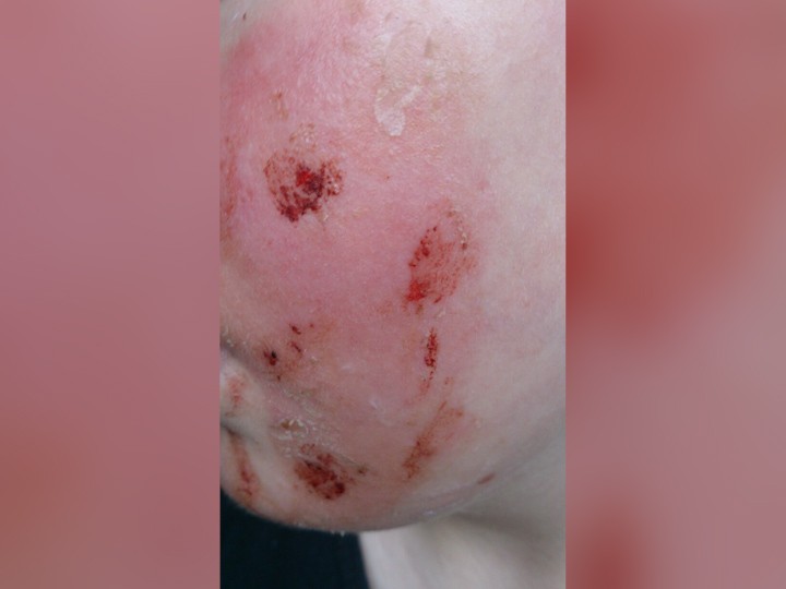 Дівчинка впевнена, що це сталося не випадково - щось адже завадило зловмисникові вилити суміш в каналізацію