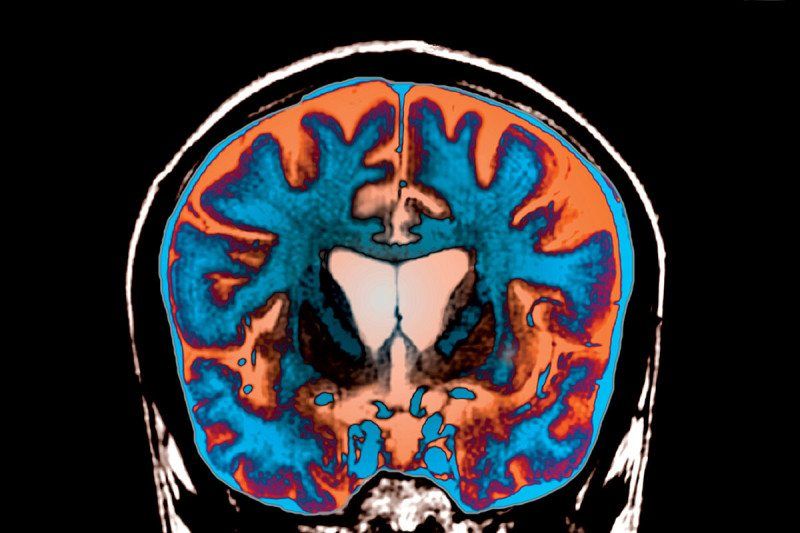 Навіть нетривалі події впливають на формування анатомії різних ділянок мозку