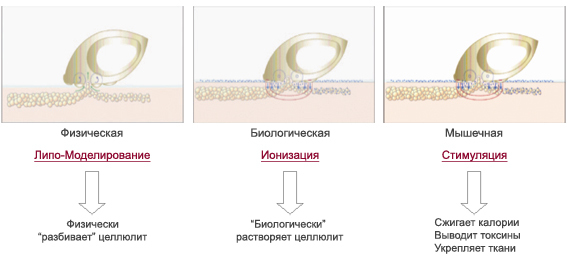 Вже після першої процедури Ви помітите результат