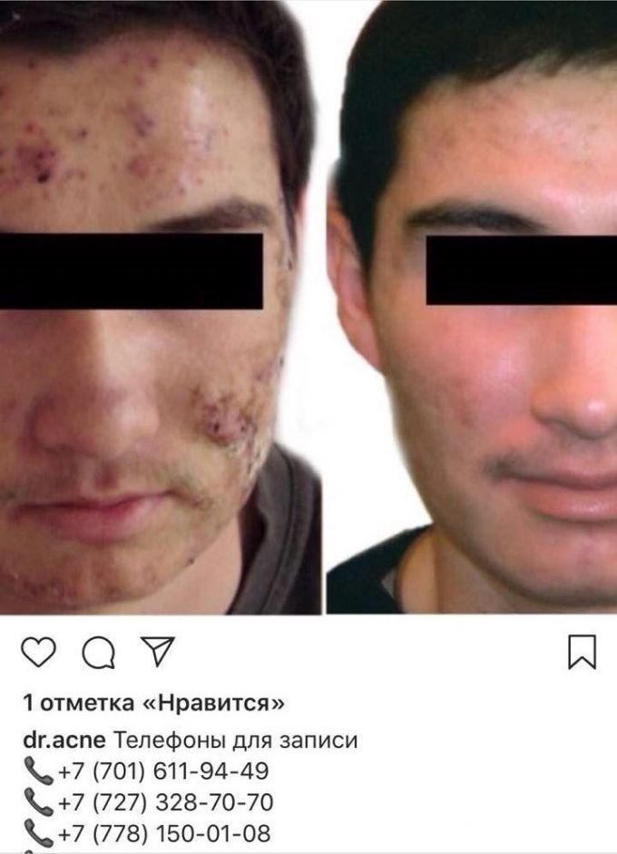 Має вищу освіту, проходила навчання в Росії, Бразилії, Німеччини, США, Італії, є професіоналом в області косметології і дерматології і проводить всі види лікування проблемної шкіри