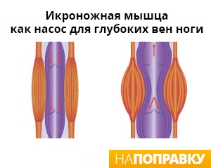 Однак існує ряд факторів, які можуть збільшити ризик варикозу