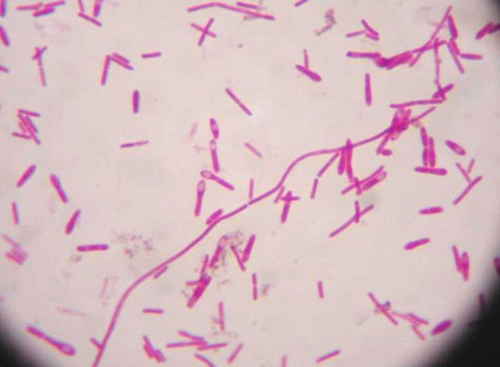 Clostridium Botulinum   - спороутворююча паличка, продукує ботулізм - одне з найбільш токсичних створінь на Землі