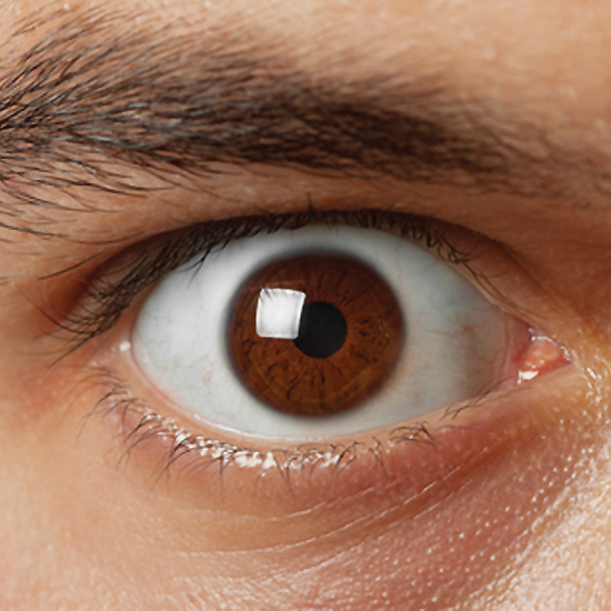 Згідно з визначенням Американської оптометріческой асоціації (American Optometric Association - АОА), синдром комп'ютерного зору - це комплекс проблем очей і зору, які долають під час близькою роботи або пов'язаних з використанням комп'ютера